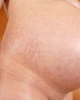 XX Cel - 78-Jul_004_p_078